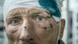 Volunteer doctors help the homeless on the streets of St. Petersburg. 
